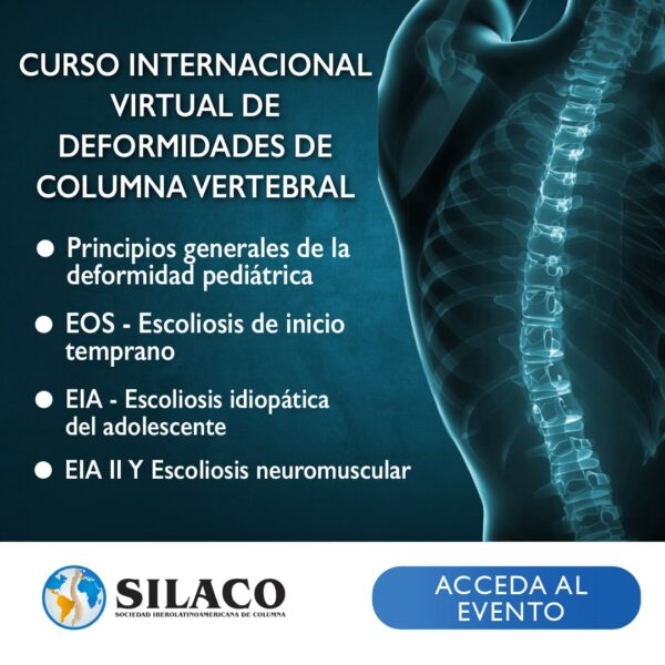 Curso Deformidades de Columna Producto Web